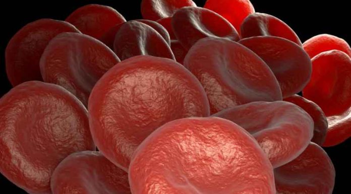 Quand s’inquiéter d’une bilirubine élevée ? Quand s’inquiéter d’une bilirubine élevée ?