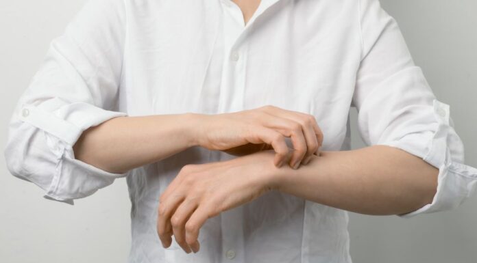 Durée de la gale sans traitement : ce qu’il faut savoir Durée de la gale sans traitement : ce qu’il faut savoir