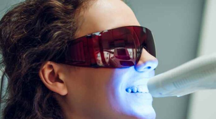 Blanchiment dentaire professionnel : la solution ultime pour retrouver un joli sourire Blanchiment dentaire professionnel : la solution ultime pour retrouver un joli sourire